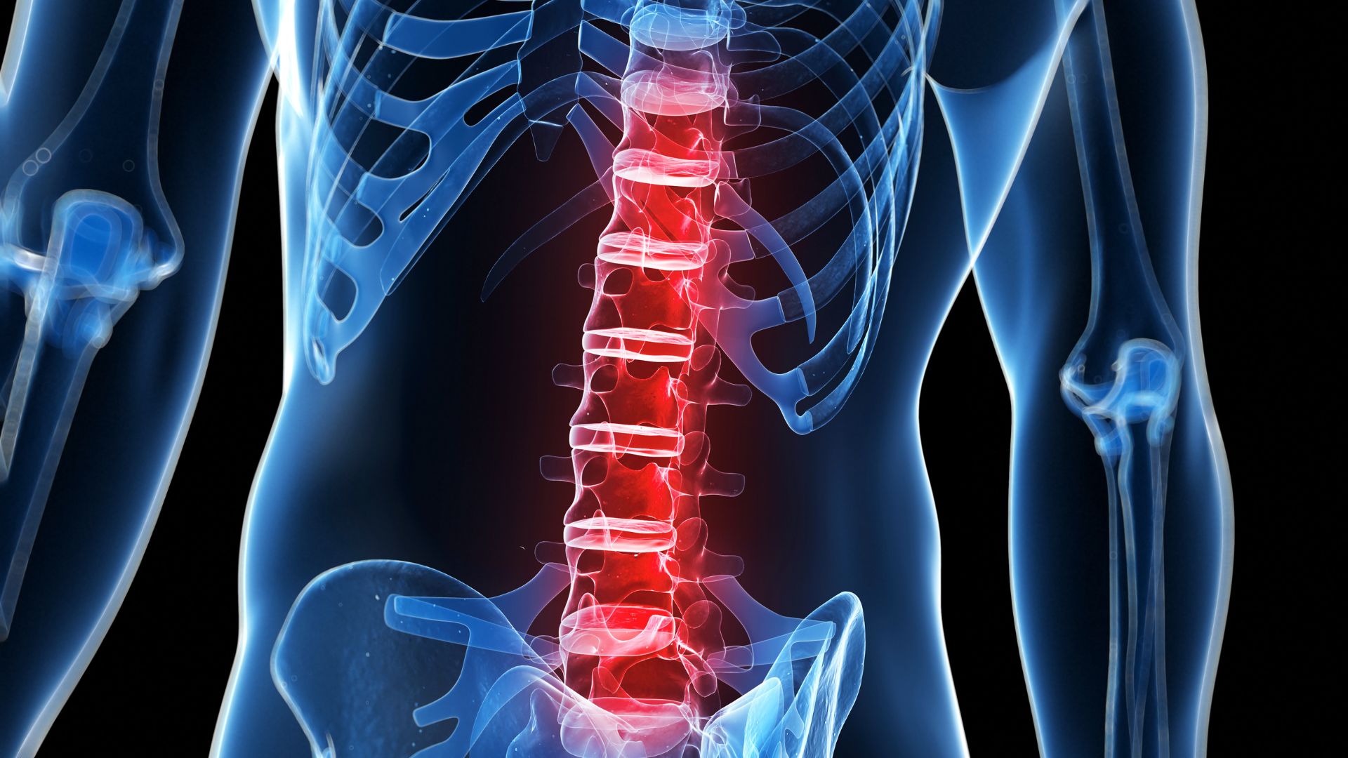 low back pain