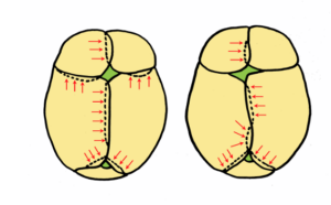 Osteopatia Pediatrica