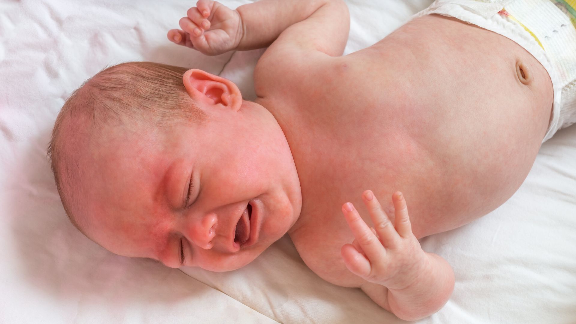 Infant Distress Syndrome